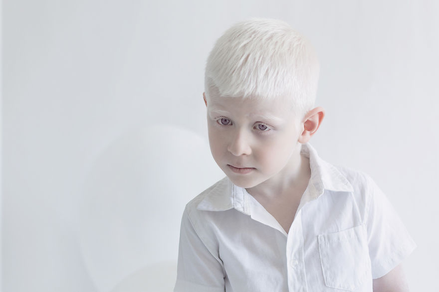Frumusete de portelan: Splendoarea oamenilor albinosi - Poza 9