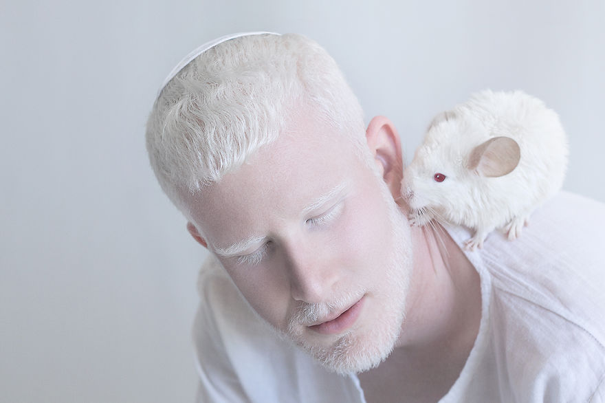 Frumusete de portelan: Splendoarea oamenilor albinosi - Poza 7