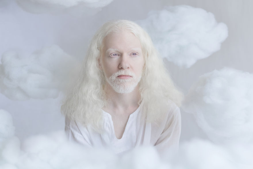 Frumusete de portelan: Splendoarea oamenilor albinosi - Poza 3