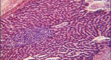 Cand vom scapa de cancer?