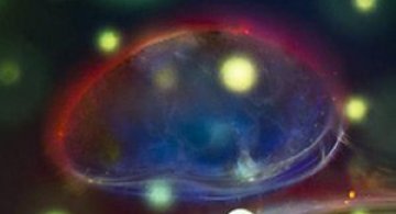 Intre microbiologie si arta – Daniel Stoupin