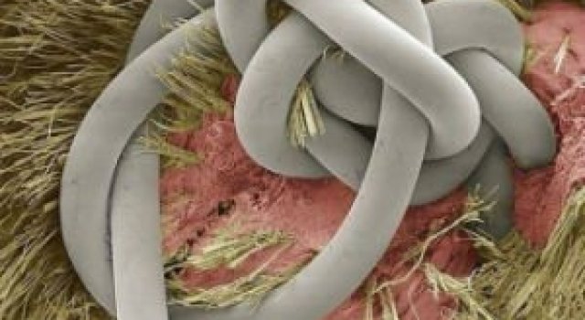Lumea, sub lupa microscopului: Partea nevazuta a lucrurilor simple