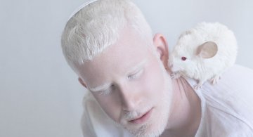 Frumusete de portelan: Splendoarea oamenilor albinosi